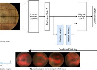 Researchers have developed a self-learning software able to identify vascular changes in patients with peripheral arterial disease (PAD)