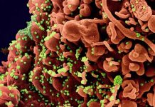 Il ruolo di SARS-CoV-2 nella patogenesi del danno testicolare
