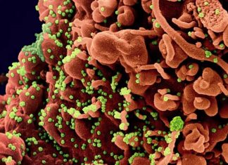 Il ruolo di SARS-CoV-2 nella patogenesi del danno testicolare