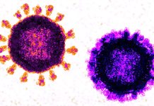 Adults in hospital who have COVID-19 and the flu at the same time are at much greater risk of severe disease and death