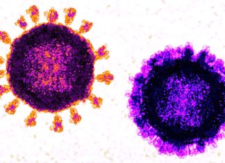 Adults in hospital who have COVID-19 and the flu at the same time are at much greater risk of severe disease and death