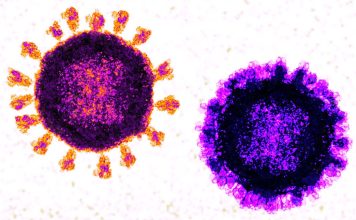Adults in hospital who have COVID-19 and the flu at the same time are at much greater risk of severe disease and death