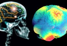 Few beers or glasses of wine a week may carry risks to the brain