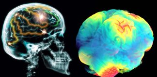 Few beers or glasses of wine a week may carry risks to the brain