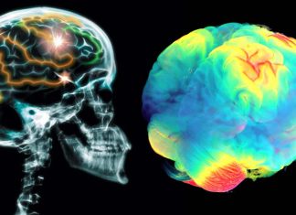 Few beers or glasses of wine a week may carry risks to the brain