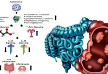 La disbiosi del microbioma intestinale indotta da SARS-CoV-2 aumenta il rischio di cancro colorettale
