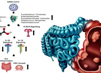 La disbiosi del microbioma intestinale indotta da SARS-CoV-2 aumenta il rischio di cancro colorettale