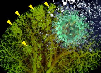 COVID-19: excessive neuropeptide secretion by neuroendocrine cells in the lungs can lead to fluid buildup and poor oxygenation