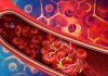 Majority Of Post-COVID-19 Individuals Have Immune And Clotting Dysfunction Which Can Be Detected Via Plasma And Saliva