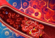 Majority Of Post-COVID-19 Individuals Have Immune And Clotting Dysfunction Which Can Be Detected Via Plasma And Saliva