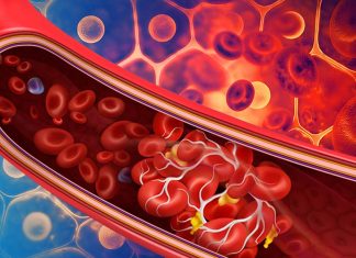 Majority Of Post-COVID-19 Individuals Have Immune And Clotting Dysfunction Which Can Be Detected Via Plasma And Saliva