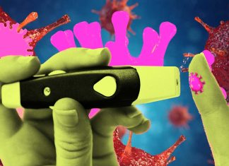 Anche lievi infezioni da SARS-CoV-2 stanno innescando il diabete di tipo 2 di nuova insorgenza