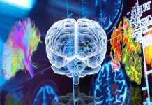 Damage to the multiple demand network causes people with dementia to struggle to adapt to changes in their environment
