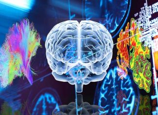 Damage to the multiple demand network causes people with dementia to struggle to adapt to changes in their environment