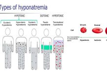 Global warming increase the number of people requiring hospitalization due to hyponatremia