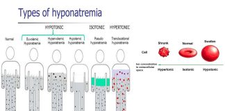 Global warming increase the number of people requiring hospitalization due to hyponatremia