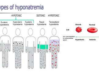 Global warming increase the number of people requiring hospitalization due to hyponatremia