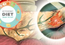 Ketogenic diet helps to kill pancreatic cancer cells when combined with a triple-drug therapy developed by the TGen
