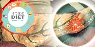 Ketogenic diet helps to kill pancreatic cancer cells when combined with a triple-drug therapy developed by the TGen