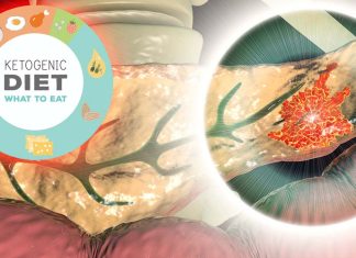 Ketogenic diet helps to kill pancreatic cancer cells when combined with a triple-drug therapy developed by the TGen