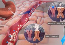 PKM2 as a potential therapeutic target for the prevention of diabetes-related kidney disease