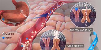 PKM2 as a potential therapeutic target for the prevention of diabetes-related kidney disease