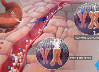 PKM2 as a potential therapeutic target for the prevention of diabetes-related kidney disease