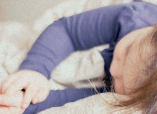 Down syndrome: Tongue stimulation device reduces sleep apnea in adolescents