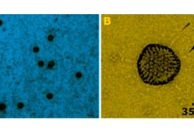 Adenovirus 41 could be at the basis of mysterious cases of childhood hepatitis