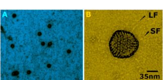Adenovirus 41 could be at the basis of mysterious cases of childhood hepatitis
