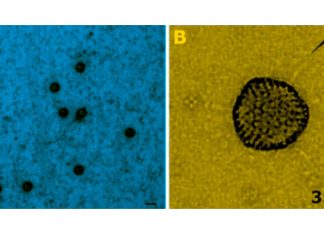 Adenovirus 41 could be at the basis of mysterious cases of childhood hepatitis