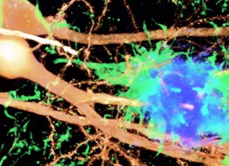 Type 1 interferon is a major driver of cognitive impairment and memory loss in Alzheimer’s disease