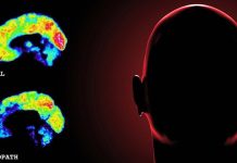 Contrariamente alla credenza popolare, gli psicopatici possono provare emozioni e possono essere curati