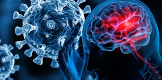 SARS-CoV-2 Infections Can Lead To Brain Inflammation – Hypoxia / Bleeding And Strokes