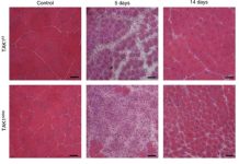 Supraphysiological activation of TAK1 in skeletal muscle stimulates translational machinery – protein synthesis and myofiber growth