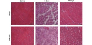 Supraphysiological activation of TAK1 in skeletal muscle stimulates translational machinery – protein synthesis and myofiber growth