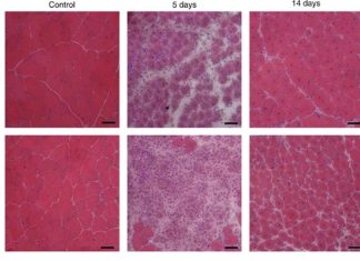 Supraphysiological activation of TAK1 in skeletal muscle stimulates translational machinery – protein synthesis and myofiber growth