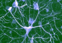 Abnormalities in astrocytes can cause some behavioral symptoms of autism spectrum disorders