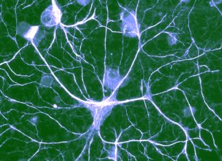 Abnormalities in astrocytes can cause some behavioral symptoms of autism spectrum disorders