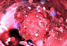 SARS-CoV-2 Infected Cells Trigger Host Tissue Factors That Leads To Platelet Activation And Coagulation