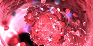 SARS-CoV-2 Infected Cells Trigger Host Tissue Factors That Leads To Platelet Activation And Coagulation