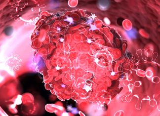 SARS-CoV-2 Infected Cells Trigger Host Tissue Factors That Leads To Platelet Activation And Coagulation