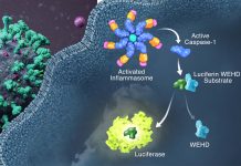 SARS-CoV-2 Infects Immune Cells Directly Causing Inflammasome Activation That Leads To Hyperinflammation In Lungs