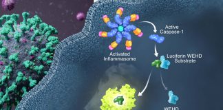 SARS-CoV-2 Infects Immune Cells Directly Causing Inflammasome Activation That Leads To Hyperinflammation In Lungs