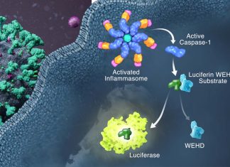 SARS-CoV-2 Infects Immune Cells Directly Causing Inflammasome Activation That Leads To Hyperinflammation In Lungs