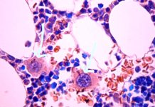 SARS-Cov-2 proliferates in neurons of the myenteric plexus and in megakaryocytes