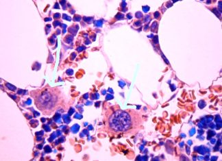 SARS-Cov-2 proliferates in neurons of the myenteric plexus and in megakaryocytes