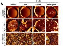 Researchers have for the first time established a link between depressive disorders and mechanical changes in blood cells