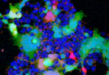 Covid-19: The BA.2 Subvariants With The Concerning Mutations L452Q – L452R Are Spreading Globally