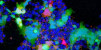 Covid-19: The BA.2 Subvariants With The Concerning Mutations L452Q – L452R Are Spreading Globally